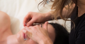 Secondary image for the New Patient Acupuncture Session with Prinz Acupuncture Auction Item
